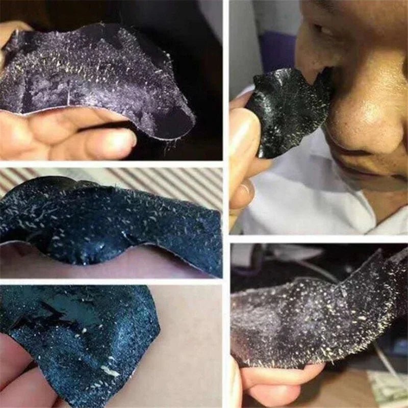 10PCS Nose Blackhead Remover Mask Deep Cleaning Shrink Pore Acne - Shemen Beauty