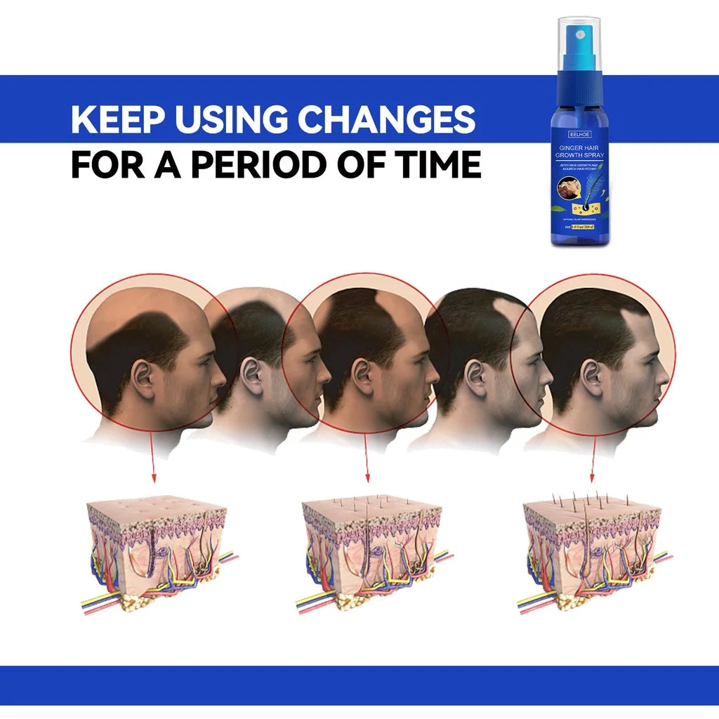 Ginger Hair Growth spray Anti Hair Fall Hair Loss Treatment Growth Essence Oil for Men Women - Shemen Beauty