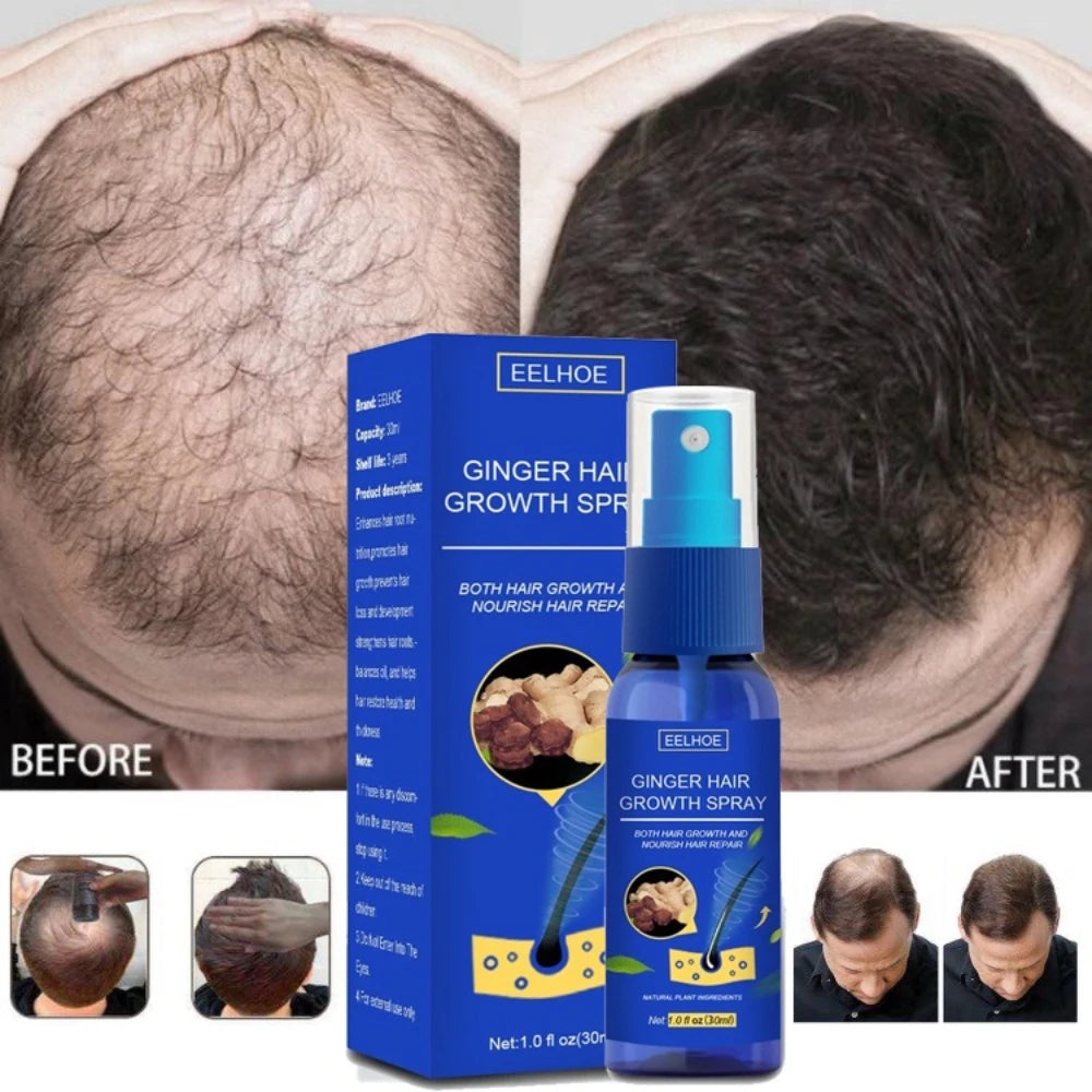 Ginger Hair Growth spray Anti Hair Fall Hair Loss Treatment Growth Essence Oil for Men Women - Shemen Beauty