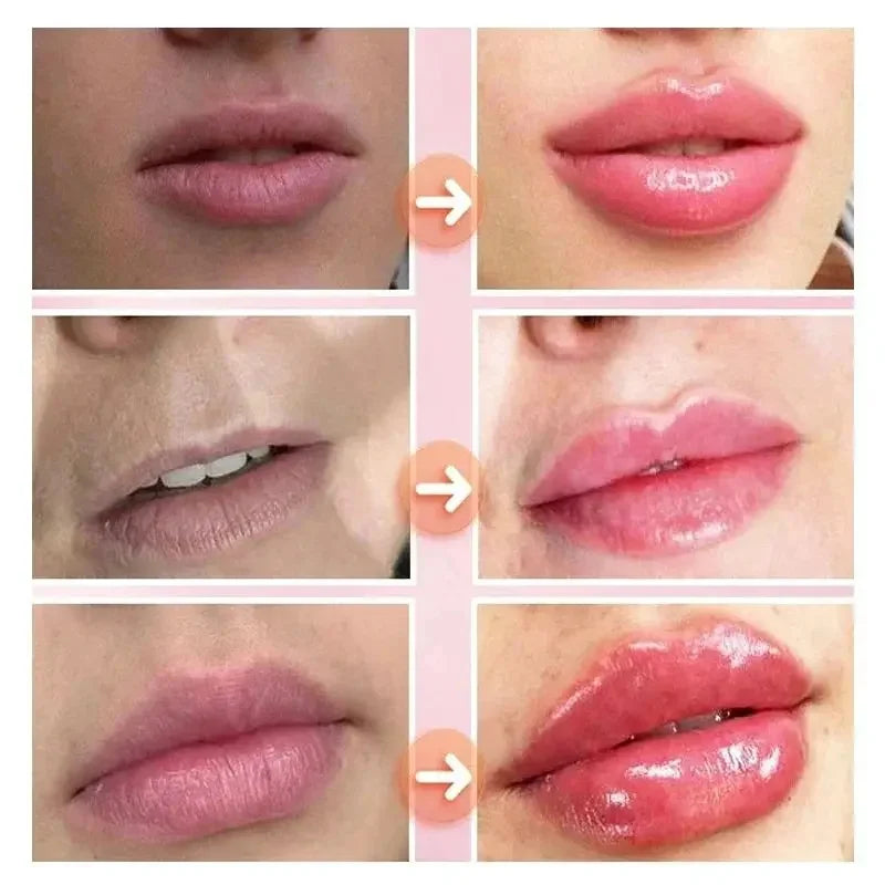 Lasting Lip Plumping Oil Instant Plumping Essential Oil Increase Lip Elasticity Lighten Lip Lines Repair Lip Lines Sexy Lips - Shemen Beauty