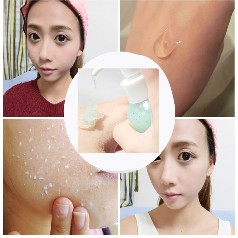 Fruit Acid Peeling Gel 120ml Facial Cleansing Exfoliating Peeling Scrub Deep Clean Acne Blackhead Remove Face Cleanser - Shemen Beauty