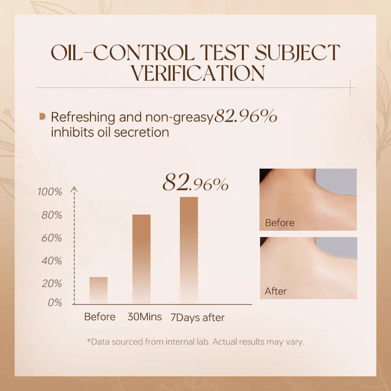 VETES Shampoo and Shower Gel Set 260ml Oil Control Tea Aroma Lasting Deepy Clean Moisturizing and Balancing Water and Oil Care - Shemen Beauty