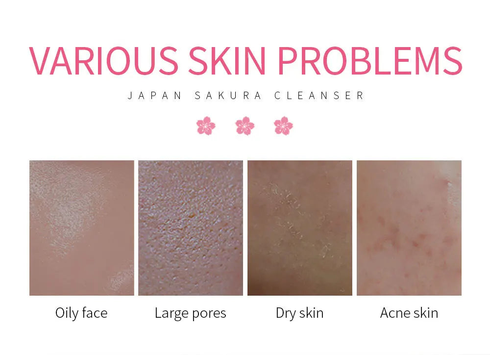 LAIKOU Facial Foaming Cleanser Deeply Cleansing Oil Control Moisturizing Blackhead Removal Skin Care Face Wash Foam Cleanser - Shemen Beauty