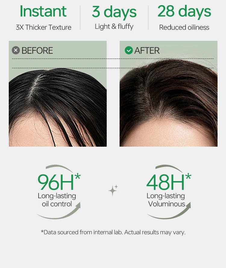 VETES Shampoo and Shower Gel Set 260ml Oil Control Tea Aroma Lasting Deepy Clean Moisturizing and Balancing Water and Oil Care - Shemen Beauty