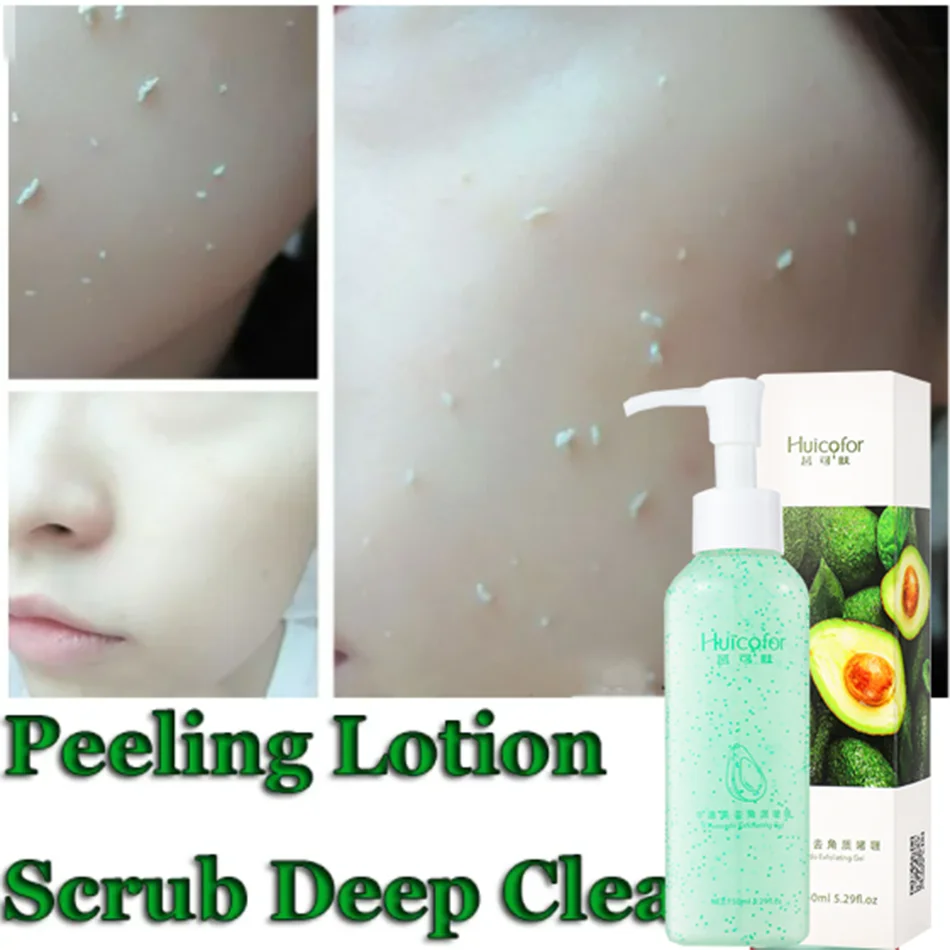 Fruit Acid Peeling Gel 120ml Facial Cleansing Exfoliating Peeling Scrub Deep Clean Acne Blackhead Remove Face Cleanser - Shemen Beauty