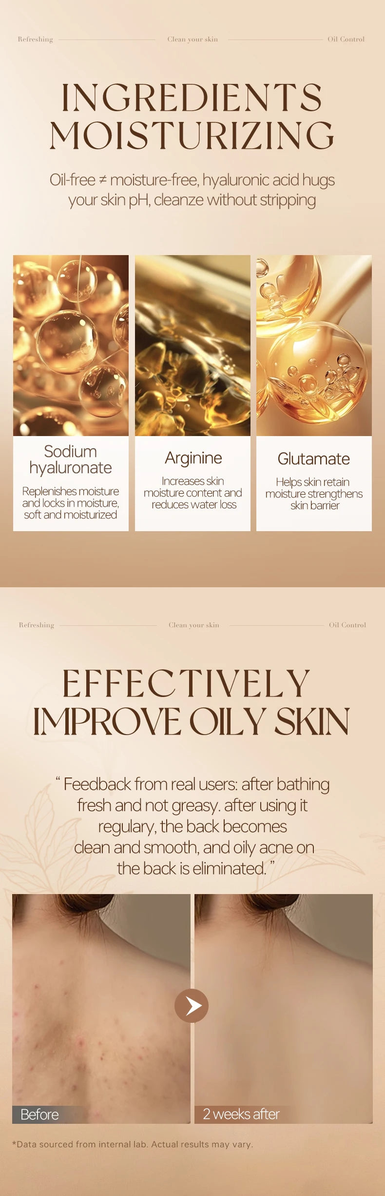 VETES Shampoo and Shower Gel Set 260ml Oil Control Tea Aroma Lasting Deepy Clean Moisturizing and Balancing Water and Oil Care - Shemen Beauty