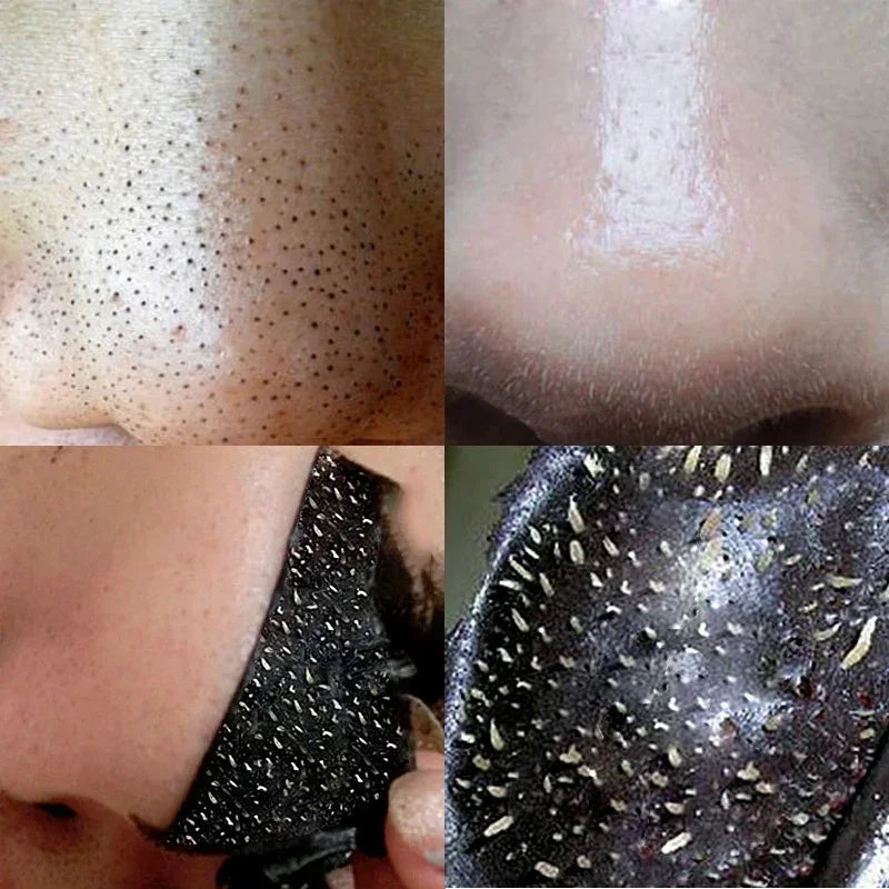 10PCS Nose Blackhead Remover Mask Deep Cleaning Shrink Pore Acne