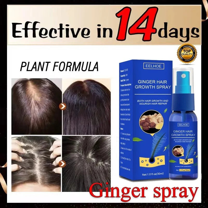 Ginger Hair Growth spray Anti Hair Fall Hair Loss Treatment Growth Essence Oil for Men Women - Shemen Beauty
