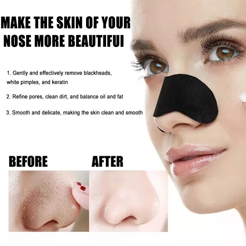 Blackhead Removal Nose Strips, Deep Cleansing And Refreshing Skin, - Shemen Beauty