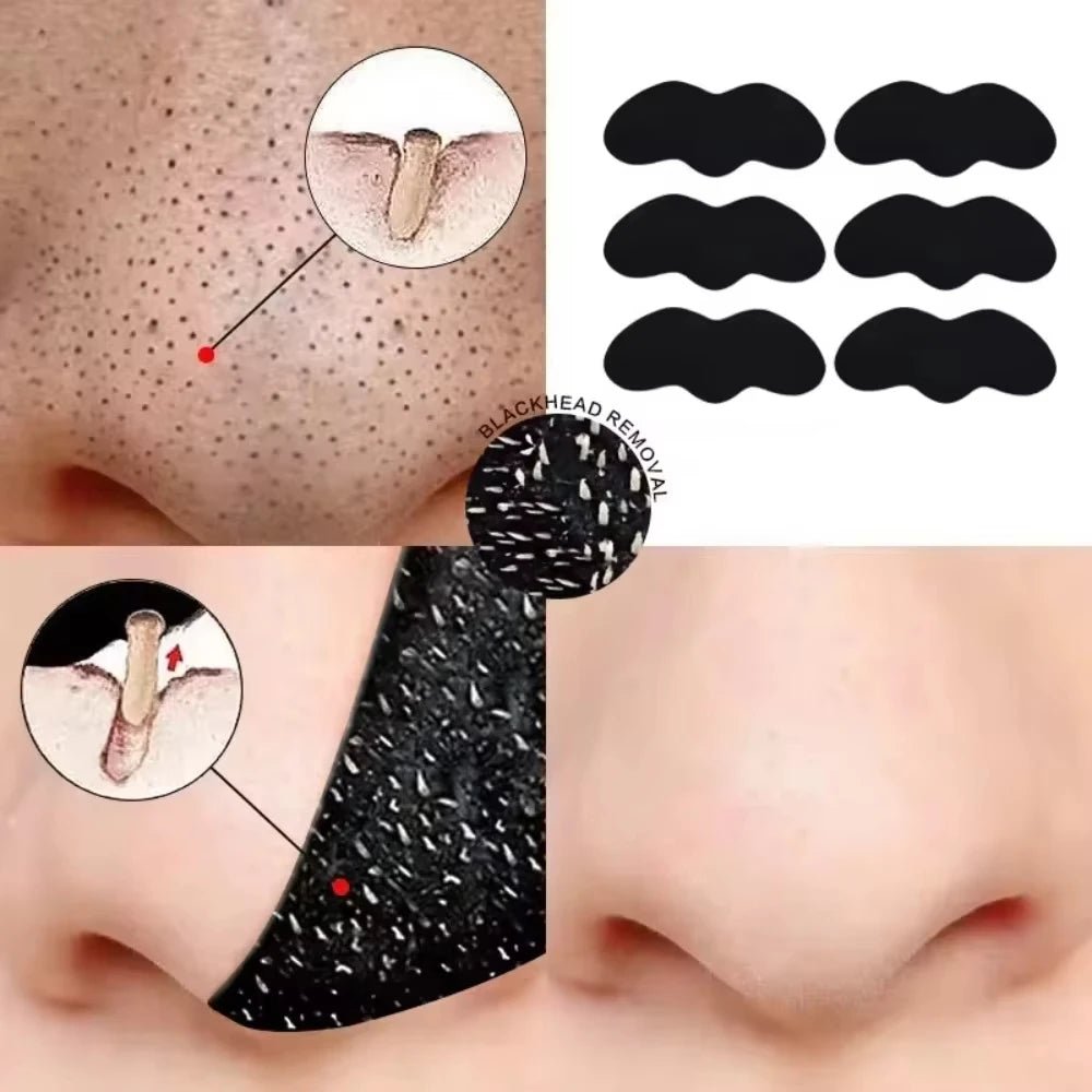 Blackhead Removal Nose Strips, Deep Cleansing And Refreshing Skin, - Shemen Beauty