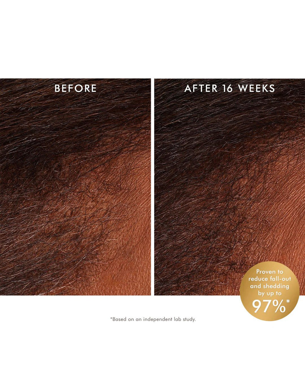 Moroccanoil Revitalizing Scalp Tonic - Shemen Beauty