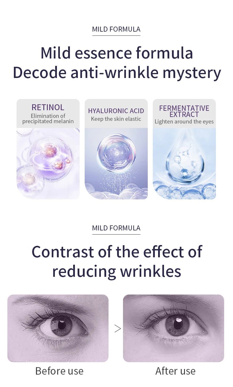 O'CHEAL Anti Wrinkle Anti Dark Circle Eye Cream Roller Massager Moisturizing Eye Bags Anti Aging Hyaluronic Acid Eye Skin Care - Shemen Beauty